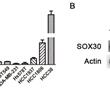 用于抑制SOX30基因表达的shRNA的应用